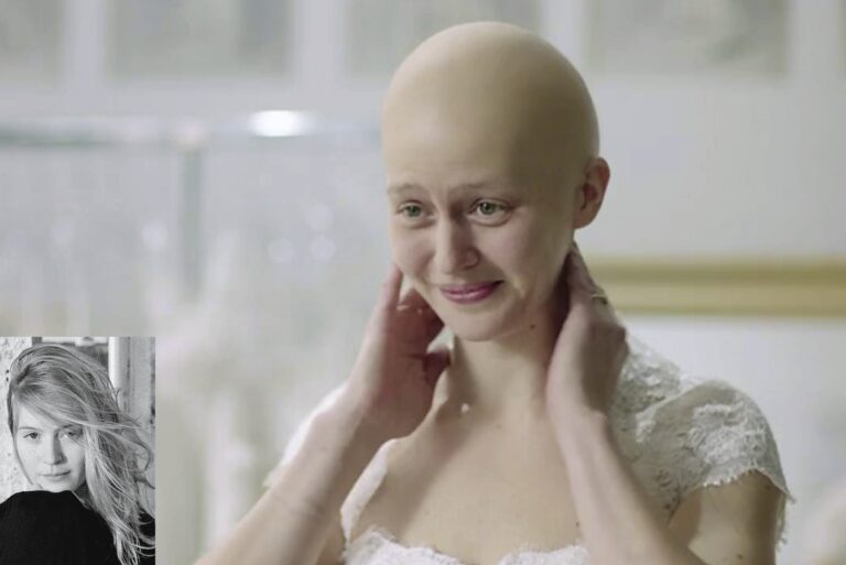 Bald head - Maija Waris (Cancerfonden)
